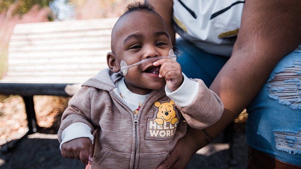 Alabama boy certified as world's most premature baby - BBC News